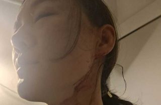 我揭露一個(gè)騙子，卻被禁言了