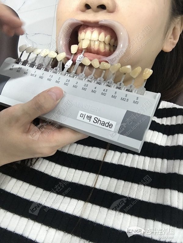 本人亲身经历,食醋柠檬片不会美白牙齿,还会破坏牙齿表面,不要再相信